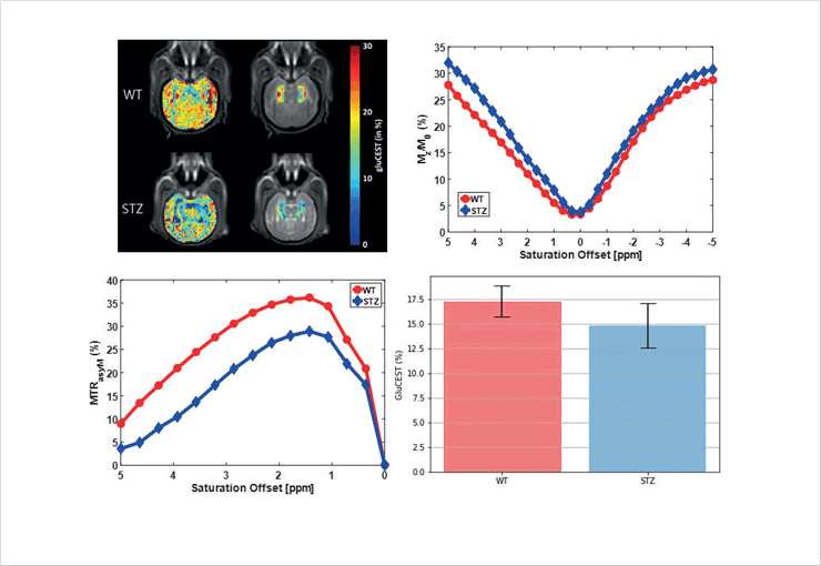 Comparison of GluCEST images between normal and
dementia monkey at 7 T human MRI