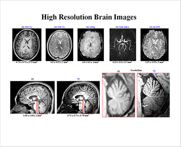 고해상도 7 T 휴먼 뇌 영상(3 T와 비교) 이미지