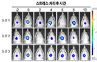 우울증과 스트레스 회복력의 관계 영상화 성공 <br />
Molecular Psychiatry / 2014.10.<br />
[교신]허송욱(춘천)