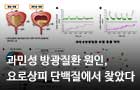 과민성 방광질환 원인, 요로상피 단백질에서 찾았다<br />
Molecular and Cellular Proteomics / 2018. 02.<br />
[제1]박창균, 김승일(바이오융합) / [교신]김건화(바이오융합), 신주현(충남대)