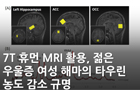 7T 휴먼 MRI 활용, 젋은 우울증 여성 해마의 타우린 농도 감소 규명<br />
Biol. Psychiatry / 2024. 3. <br />
[제1] 송영규(KBSI 바이오이미징중개연구부), 조지현(바이오이미징중개연구부)<br />
[교신] 조경구(바이오화학분석팀), 정재준(첨단바이오의학연구부)