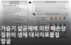 가습기 살균제에 의한 폐손상 질환의 생체 대사지표물질 발굴<br />
Environ. Health Perspect. / 2025. 5.<br />
[제1] 김진우(KBSI 수도권센터)<br />
[교신] 남명희(KBSI 바이오메디컬융합연구그룹), 홍수종(울산대학교 의과대학)