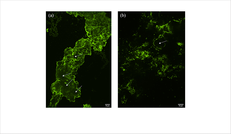 [Fig. 2] Comparison of the presence of two different sizes of fluorescent PS around the nitrifying bacteria: (a) 50 nm PS treatment and (b) 500 nm PS treatment