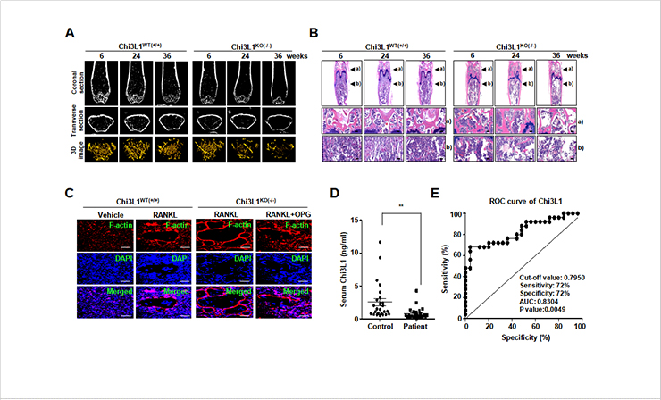 [Figure 2] The role of Chi3L1 in osteoclasts, and Chi3L1 as a clinical biomarker for bone disease