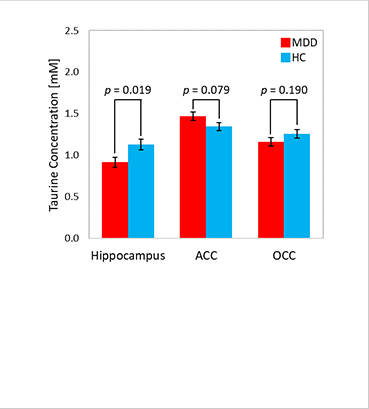 [Figure 2] Taurine concentrations in the hippocampus, frontal cortex (anterior cingulate cortex, ACC) and occipital cortex (OCC) (red: depression patient group, blue: healthy control group). 