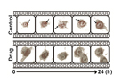 Label-Free Tomographic Imaging of Lipid Droplets 
in Foam Cells for Machine-Learning-Assisted Therapeutic Evaluation of Targeted Nanodrugs