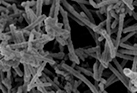 Monitoring Lung cancer drug efficacy with small chips