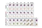 Development of self-luminescent PDT using breast cancer targeted protein