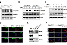 Discovery of a novel regulator for controlling aging-related bone disease