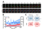 Targeting Heme Oxygenase 2 (HO2) to Overcome Metastasis