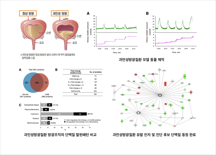 Identification of OAB inducing facter and putative
diagnostic marker by comparative proteomics
approach using rat model of OAB