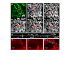 Finding regions of interest in 3D vascular organoids