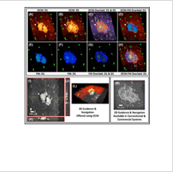 Cancer cell spheroid imaging cultured for 5 days