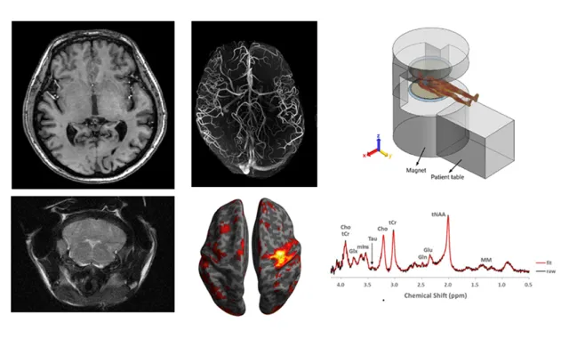 MRI기반 생체(뇌)영상, 대사체, RF 수치해석 분석연구
