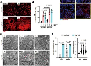마이코박테리아의 폐 감염에 대한 숙주 방어에 ATG7 유전자가 필수적임을 규명